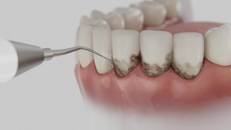 Reliable Teeth Whitening contractor in Stem, NC by Smile Center Dentistry
